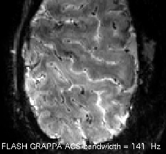 FLASH_GRAPPA_BANDWIDTH.gif