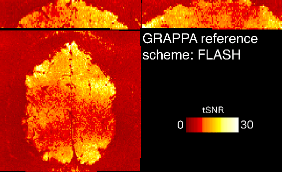 GRAPPA_reference_tlines