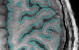 Screenshot 2018-01-05 13.33.33.png