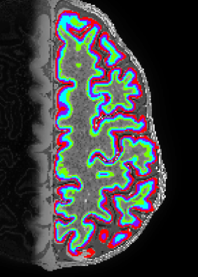 Screenshot 2018-01-05 13.43.24.png