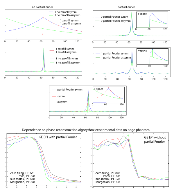 figure_Partial_fourier_effect-01.png