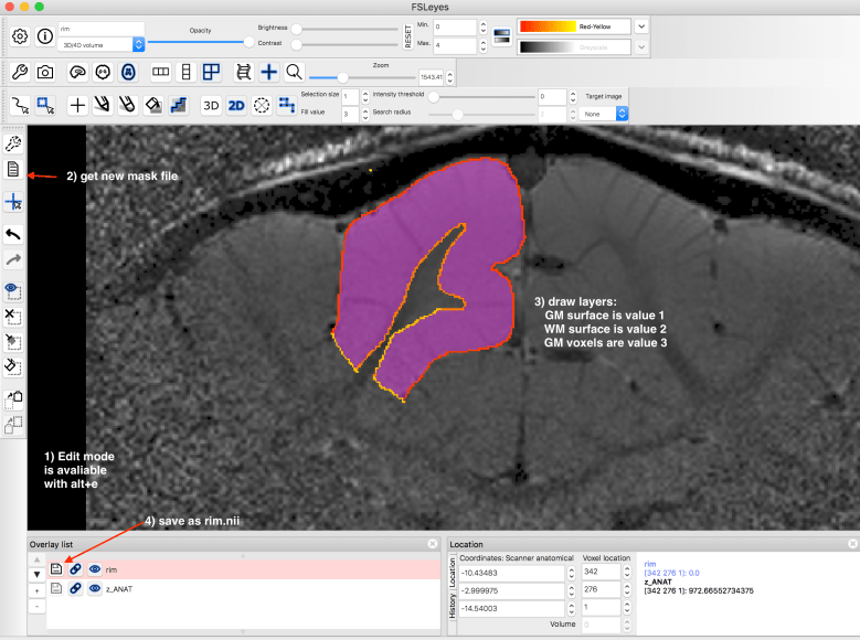 Screenshot 2018-09-26 14.43.25.png