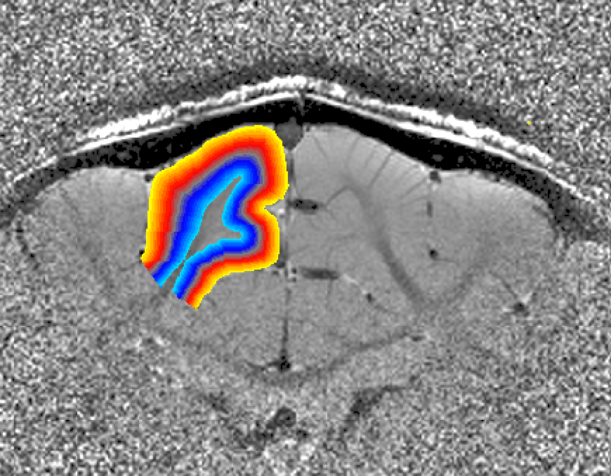 Screenshot 2018-09-26 14.47.00.png