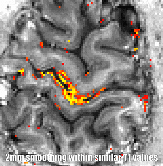 comparison with conventional.gif