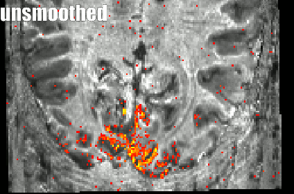 ezgif-4-19790bf3bfad