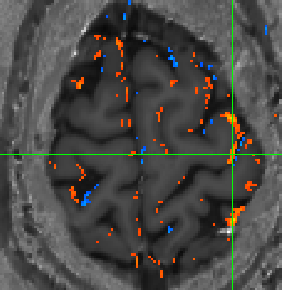 S0009_VASOactivation_M1