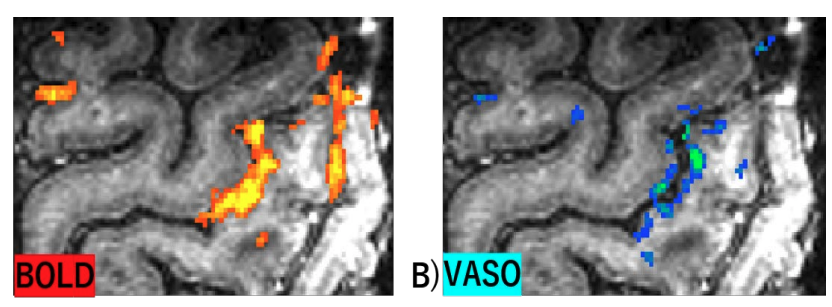 Screenshot 2021-07-20 at 14.22.50