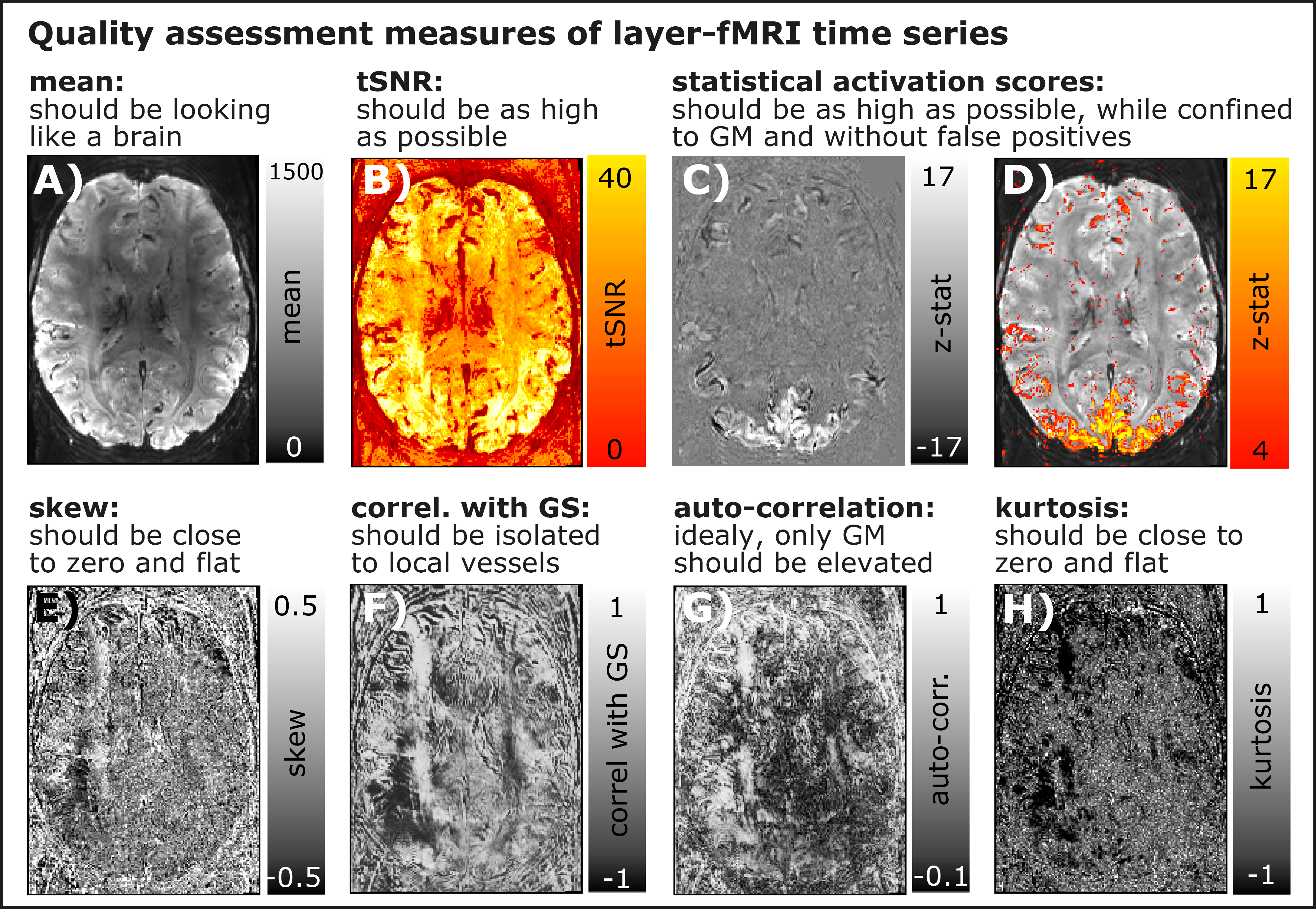 Quality assurance measures for layer-fMRI time series: How to obtain ...