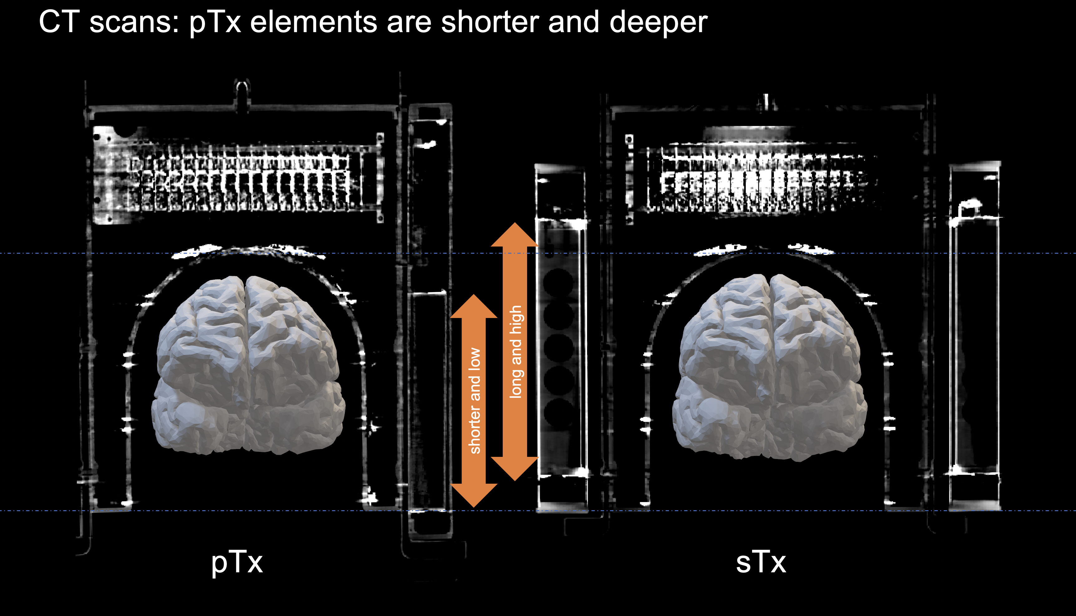 OHBM 2024 Brainhack: Hack your RF coil – layer fMRI blog