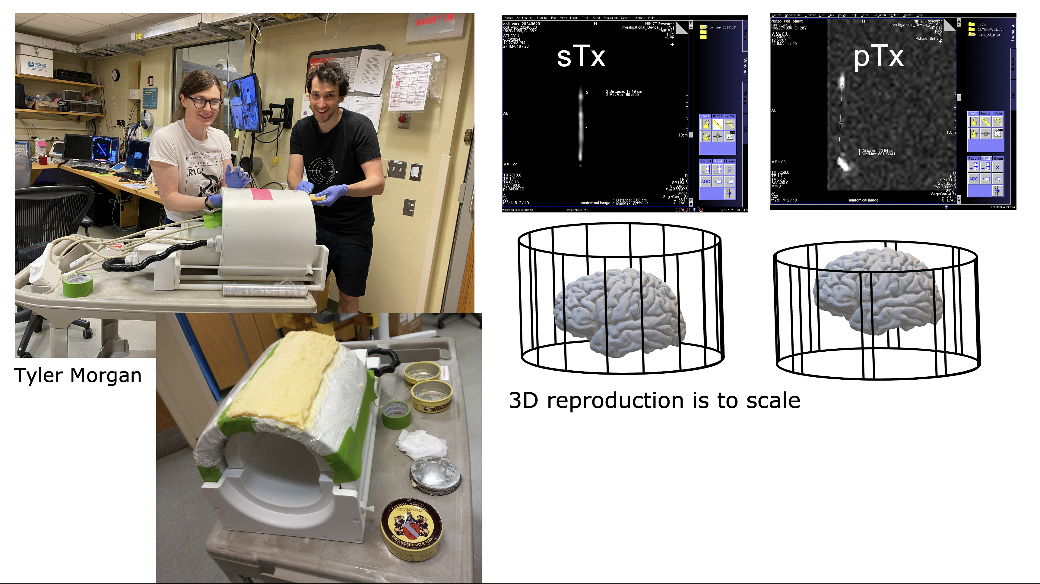 OHBM 2024 Brainhack: Hack your RF coil – layer fMRI blog